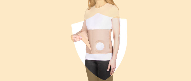 Stoma