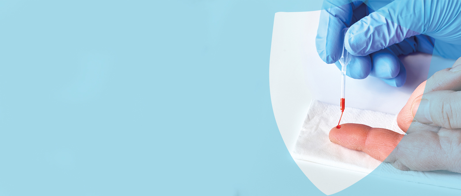 Unverträglichkeitstest