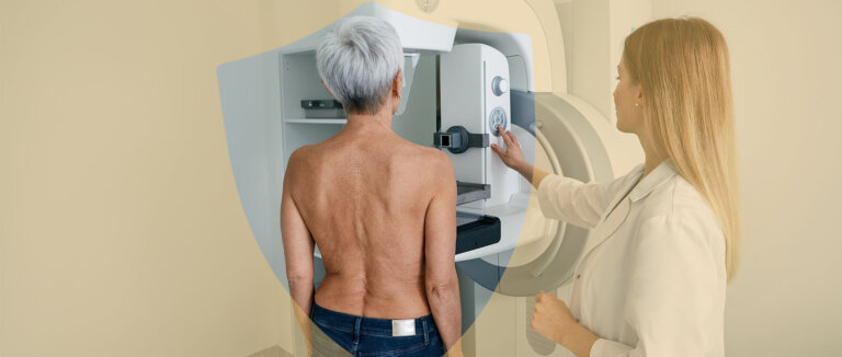 Mammographie Vorsorge